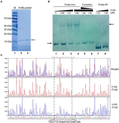 Serotype conversion gene rfbT is directly regulated by histone-like nucleoid structuring protein (H-NS) in V. cholerae O1